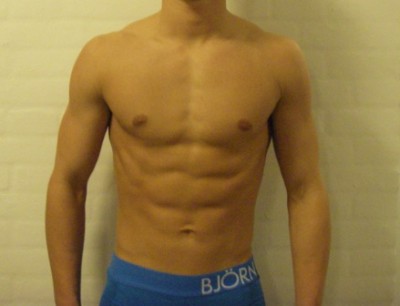 Billede