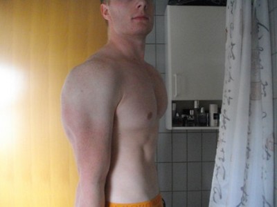 Billede