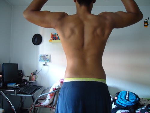 Billede