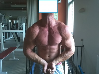 Billede